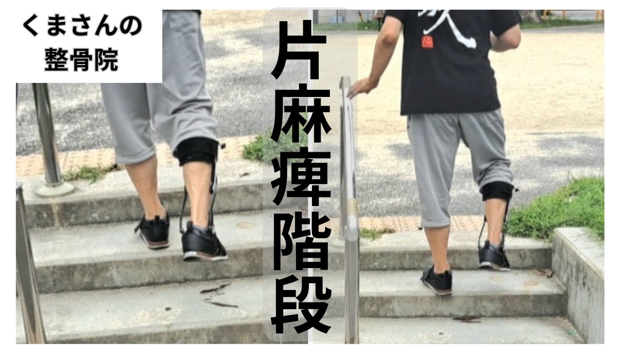普通の人のように階段を上がりたい！『片麻痺 階段』