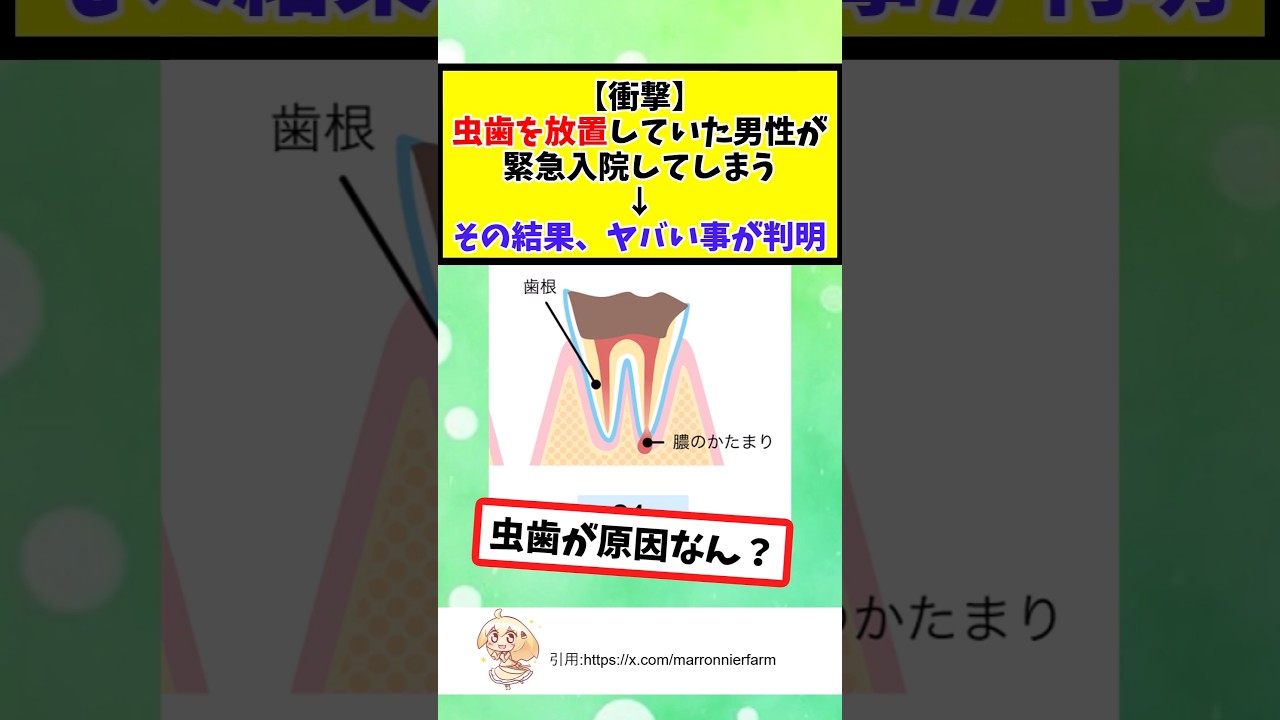 虫歯を放置していた男性が緊急入院してしまう&darr;その結果、ヤバい事が判明 #2chまとめ