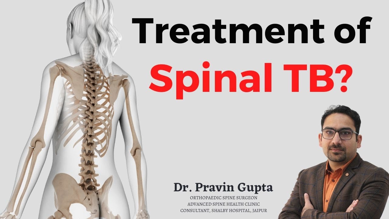 Treatment of Spinal TB | Spinal TB का इलाज | Spinal Tuberculosis | Dr. Pravin Gupta