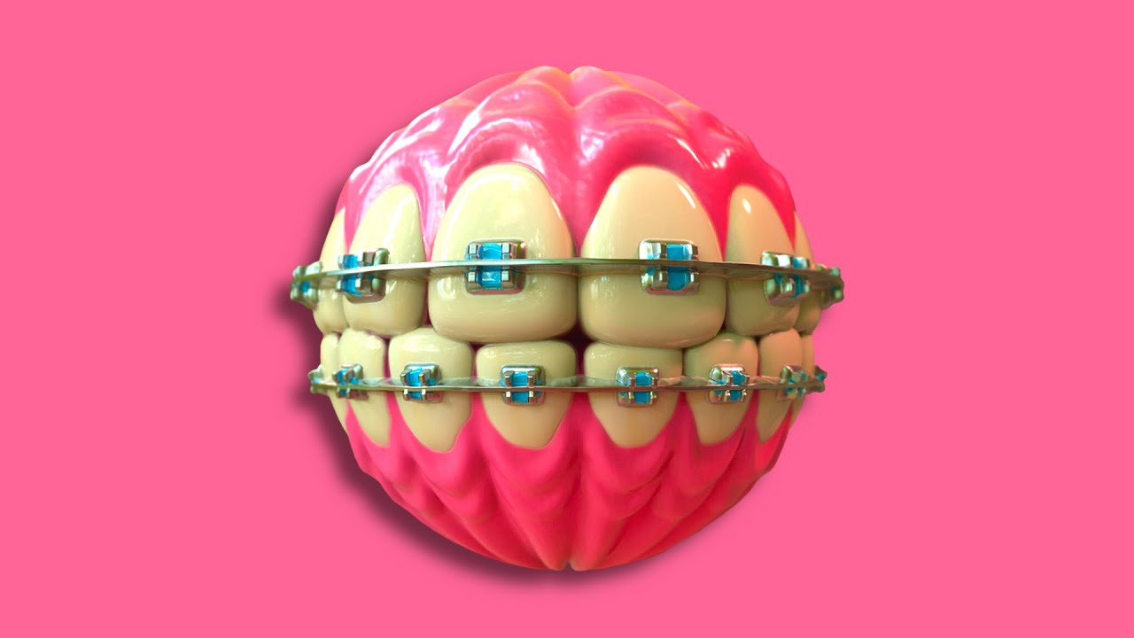 Tyga Type Beat - ''DENTIST'' ft. Offset | Free Club Type Beat [SOLD]