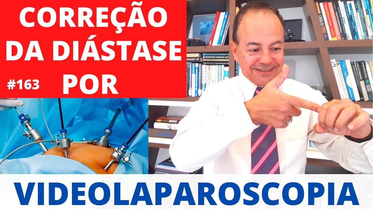 Correção da DIÁSTASE por Videolaparoscopia [Cirurgia Plástica]