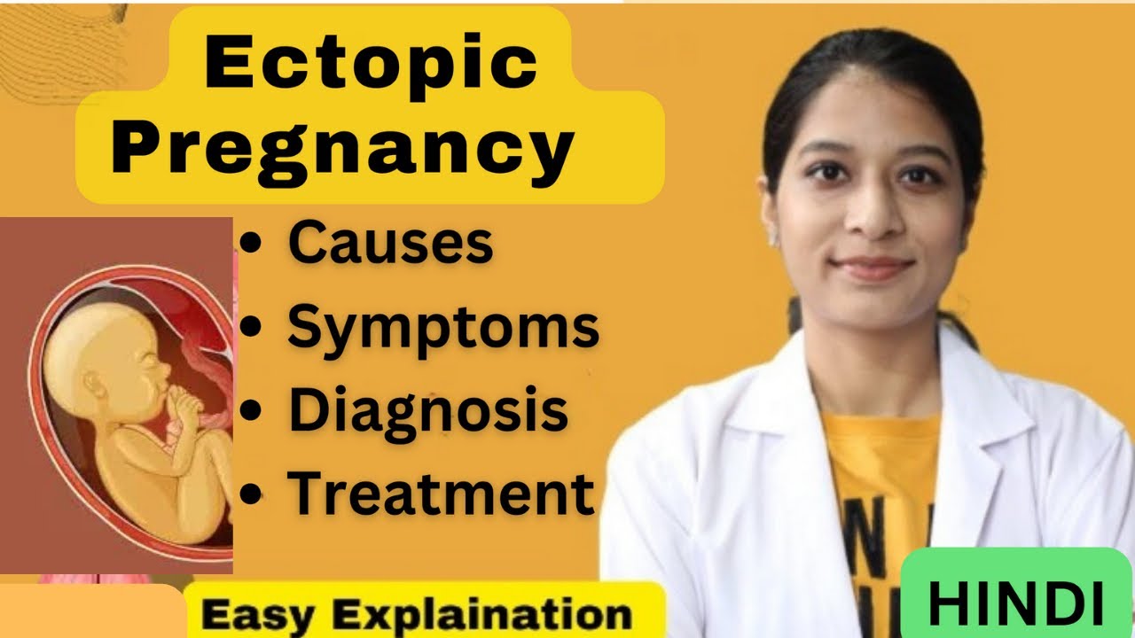 Ectopic Pregnancy in Hindi (Notes) - Causes, Signs & Symptoms, Complications, Diagnosis & Treatment