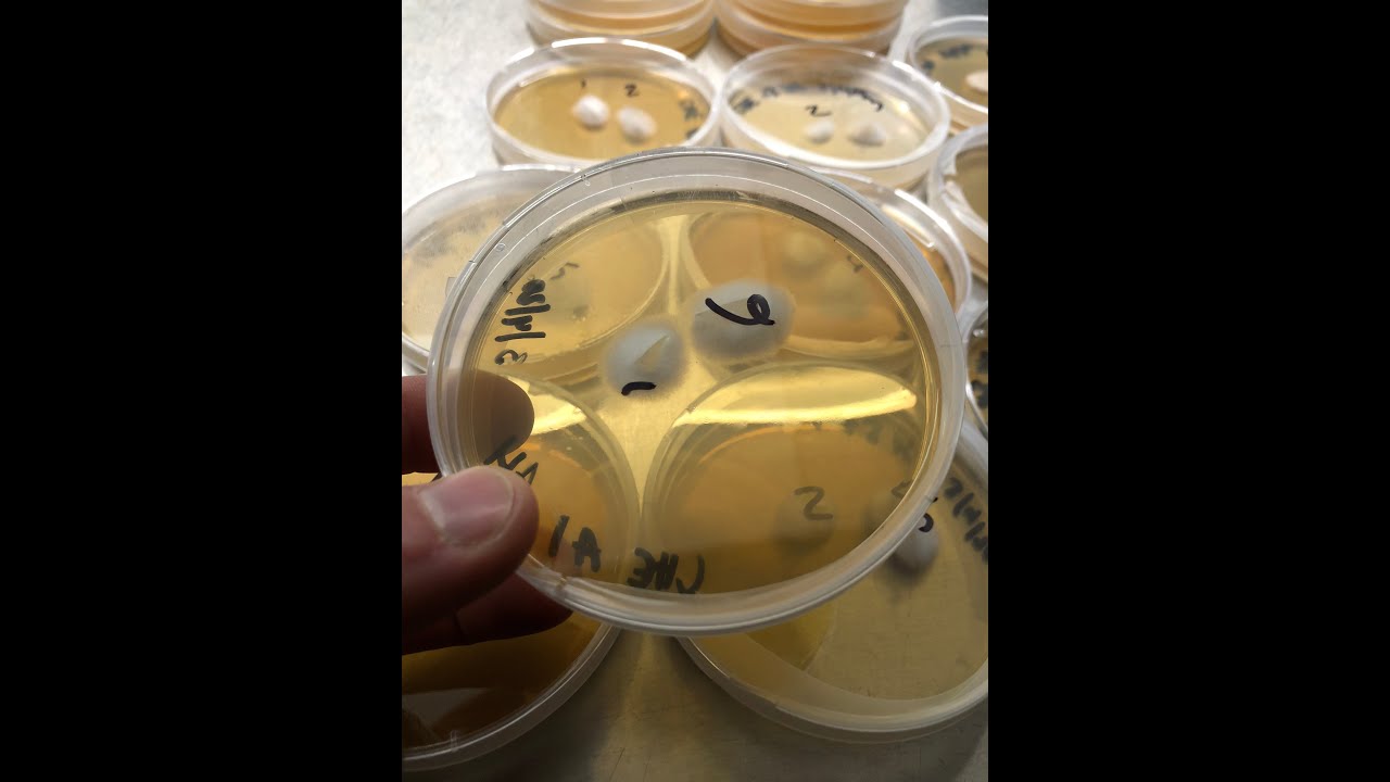 Breeding project 3 week update: Multispore liquid cultures and clamp connections
