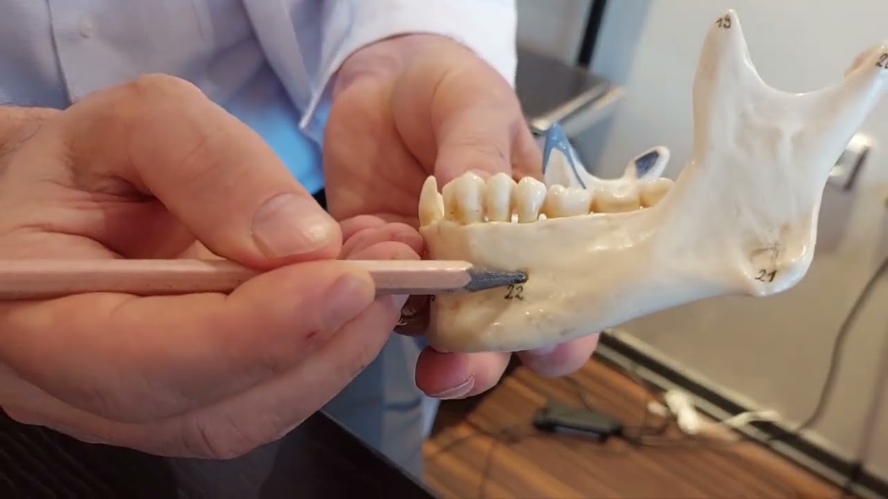 LAB4. Mandibula YAYDAR