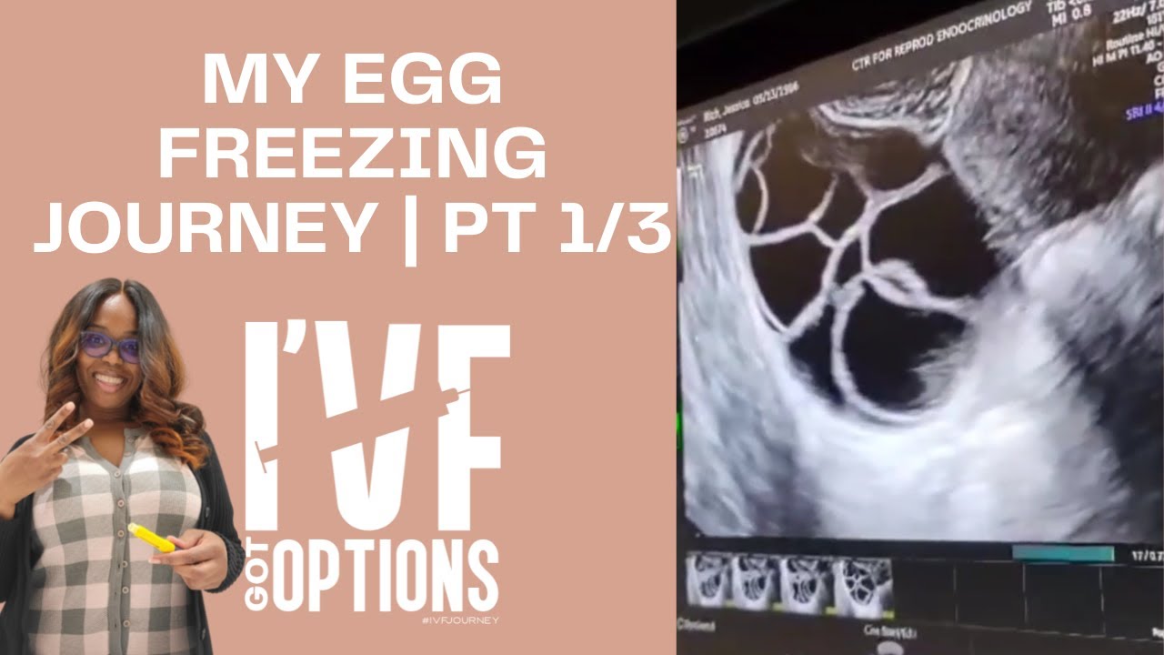 My Egg Freezing Journey | Black Woman IVF | Part 1/3