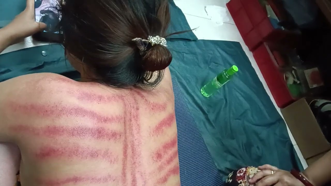 Kerokan masuk angin !!!! MAKNYAK