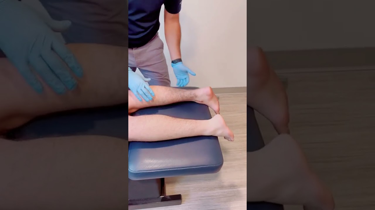 WHAT HAPPENS AFTER ANKLE FRACTURE & CASTING? 😯🦶