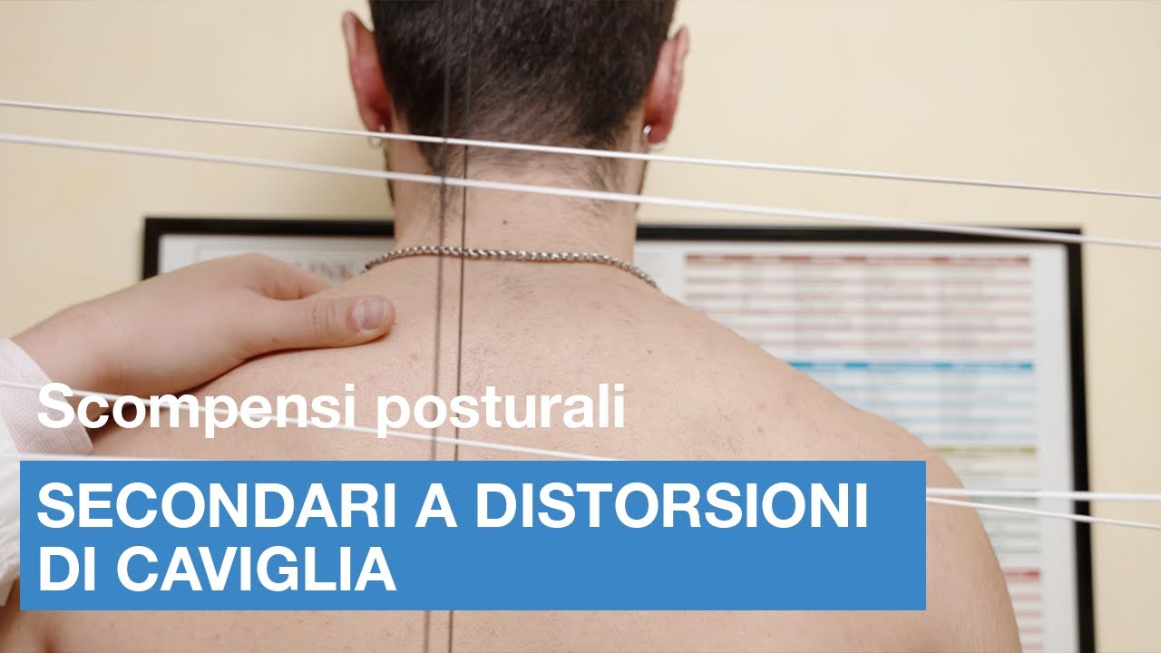 Scompensi posturali secondari a distorsioni di caviglia