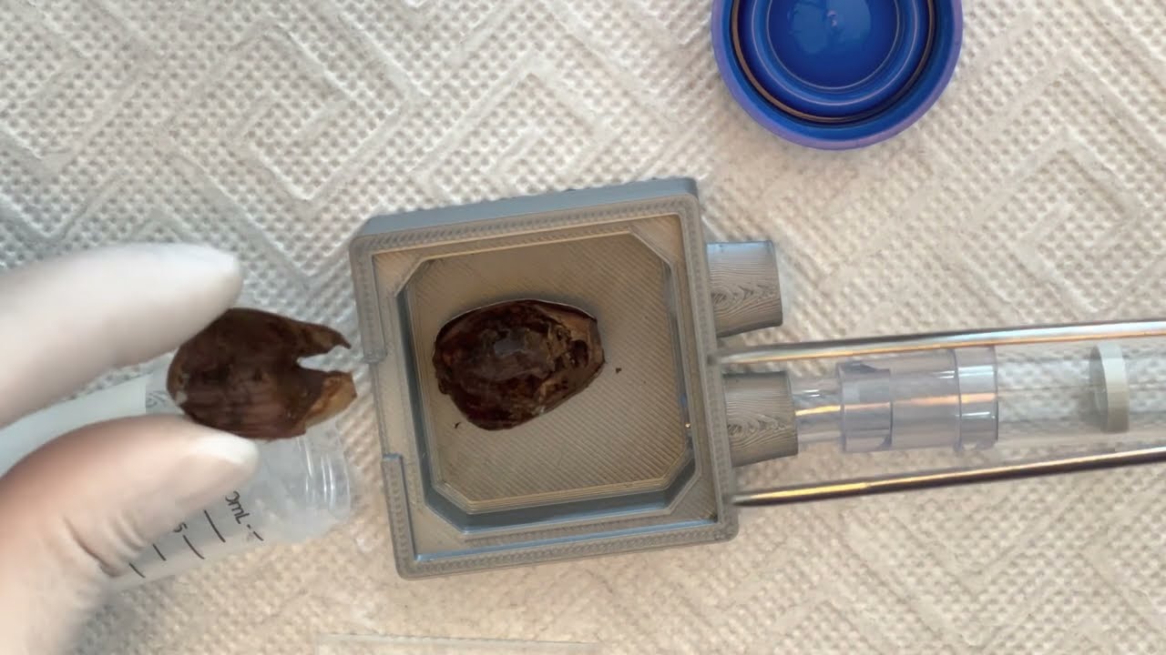 Two lucky encounters