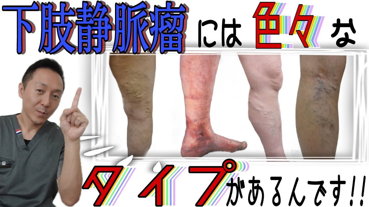 【下肢静脈瘤】実は色々な種類があるんです‼