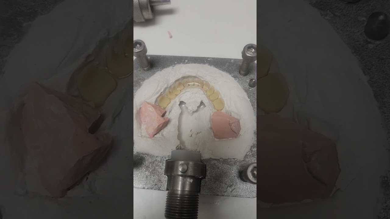 problems with flasking a denture
