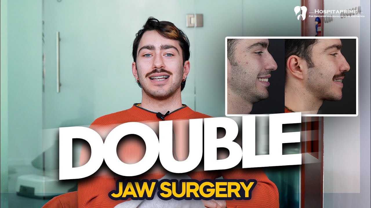 Double Jaw(Orthognathic) Surgery for Sleep Apnea patient / post surgery shares him experiance