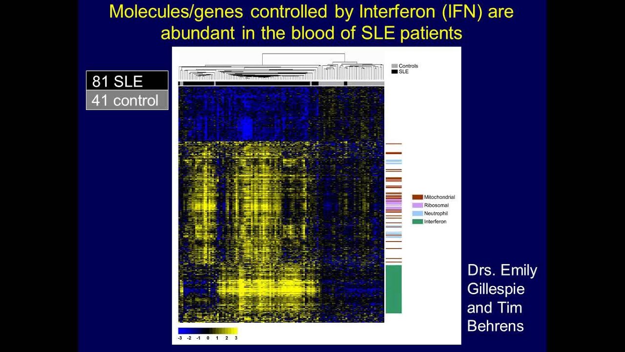 Interferon in Systemic Lupus: Friend or Foe?