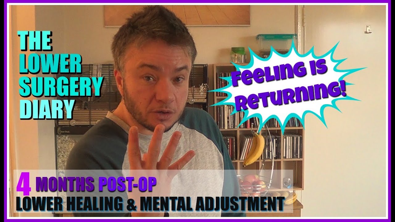 Sensation Is Returning! | 4 Months Post-Op Stage 1 (FTM Phallo)
