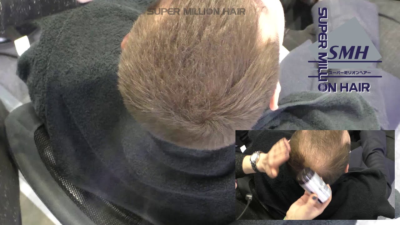 Маскировка залысин у мужчин с помощью Super Million Hair!