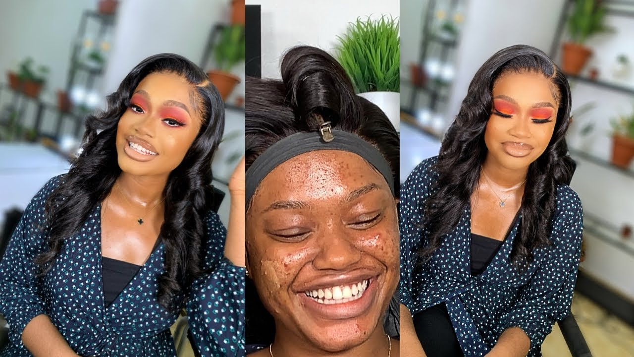 HOW TO SKIN WORK ON A PIMPLED FACE 