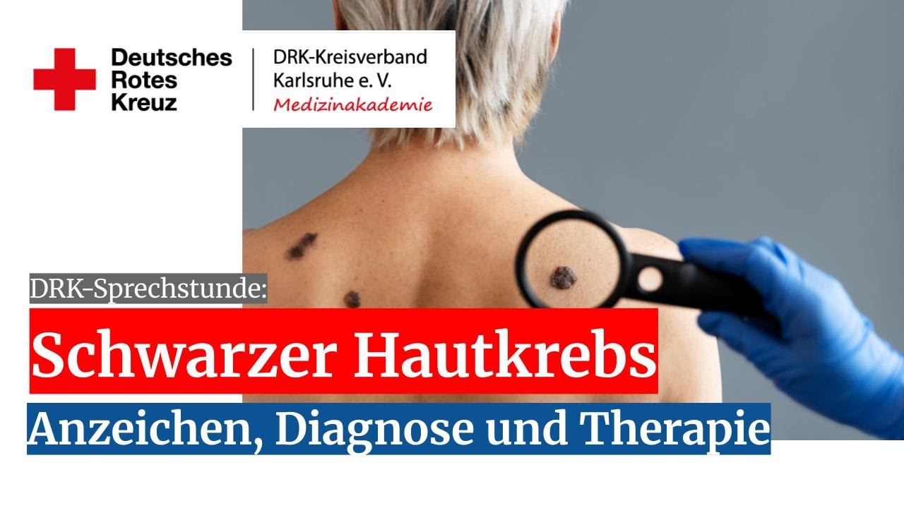 ⚫SCHWARZTER HAUTKREBS: Anzeichen & Diagnose ⚫ Dr. Dirk Meyer-Rogge I Prof. Dr. Bernd-Dieter Gonska