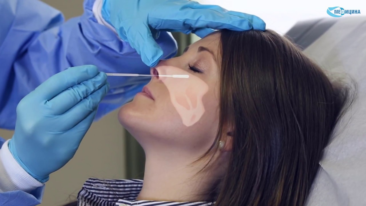 Синуситы (гайморит, фронтит и др.)