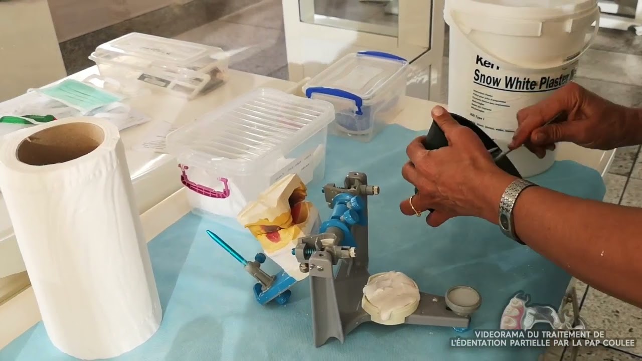Dr BELLEMKHANNATE samira   Montage de la mandibule sur articulateur