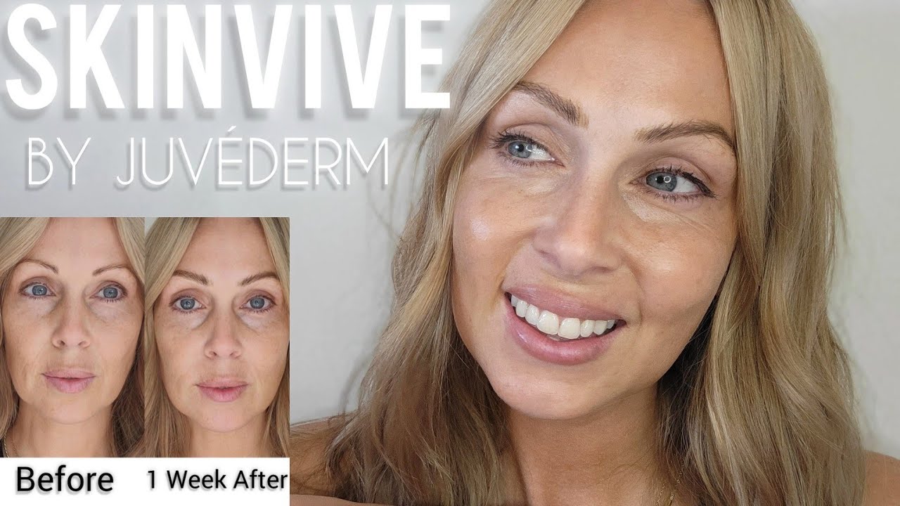 Новый Skinvive от Juv&eacute;derm / как избавиться от морщин! #уходзакожей #старше40