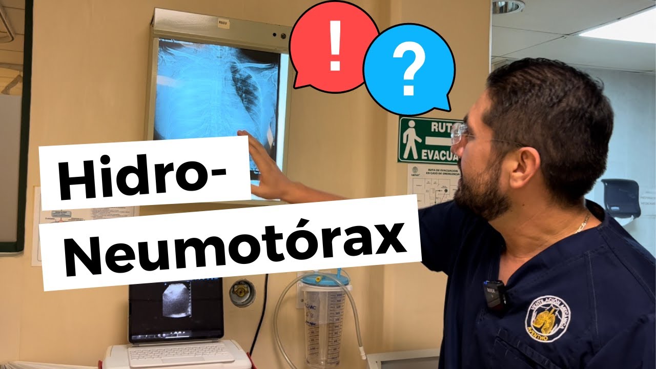 HIDRONEUMOT&Oacute;RAX 🫁 A TENSI&Oacute;N? By Dr. Zamarr&oacute;n