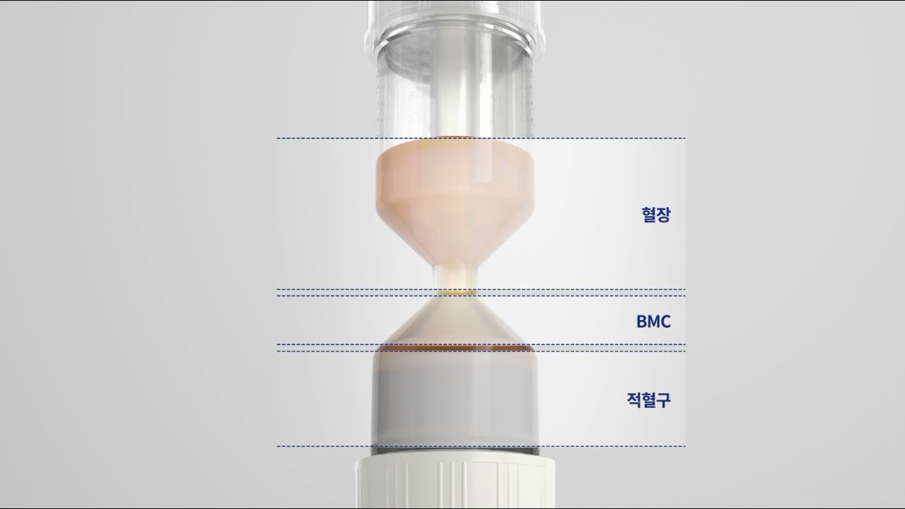 Prodizen's BMC-S30(골수 농축 키트) 사용가이드 [Kor ver]