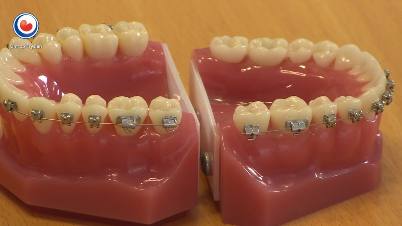 Lagere vergoeding De Friesland, 