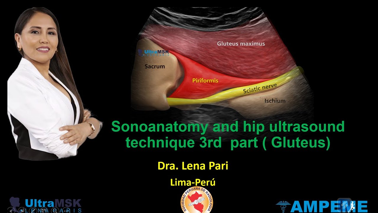 Как провести ультразвуковое исследование тазобедренного сустава у взрослых? Часть 3 или ягодичная...