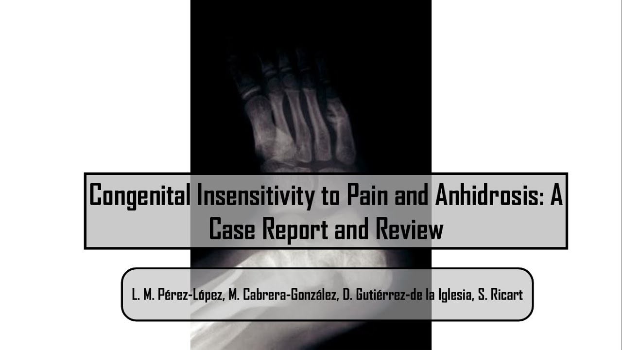 Congenital Insensitivity to Pain and Anhidrosis: A Case Report and Review