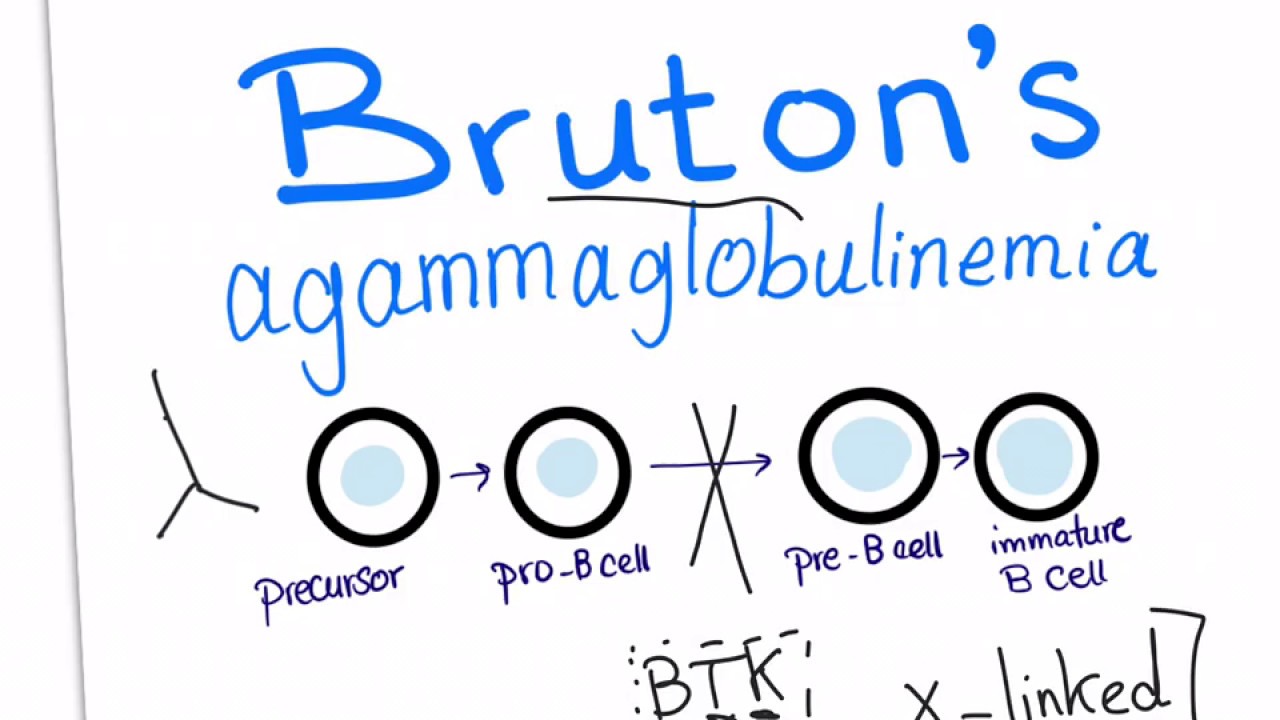 Bruton's agammaglobulinemia (X-linked agammaglobulinemia) with a mnemonic