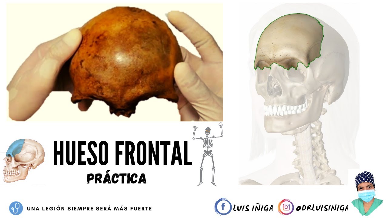 Anatomía: Hueso frontal | Generalidades, caras, bordes, accidentes | Práctica
