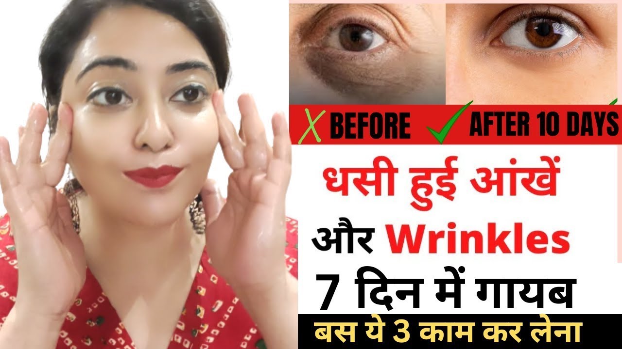 धसी हुई आंखें , Dark Circle और Wrinkles को 3 से7 दिनों में गायब करने का रामबाण घरेलू उपाय#Darkcircle