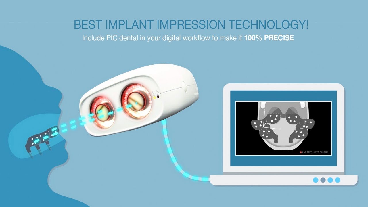 PIC dental: the world's most precise impression technology for multiple implants!