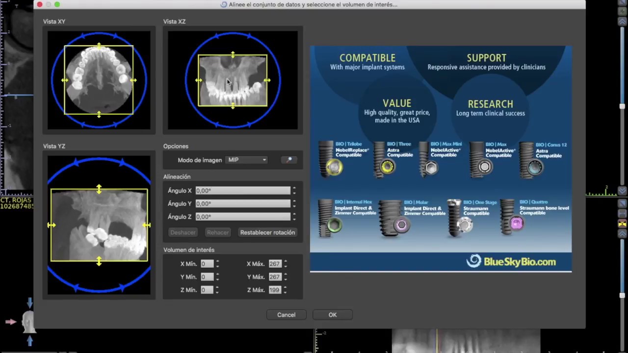 tutorial 1 Blue Sky Plan en español Abrir archivos dicom y presentación de ventanas