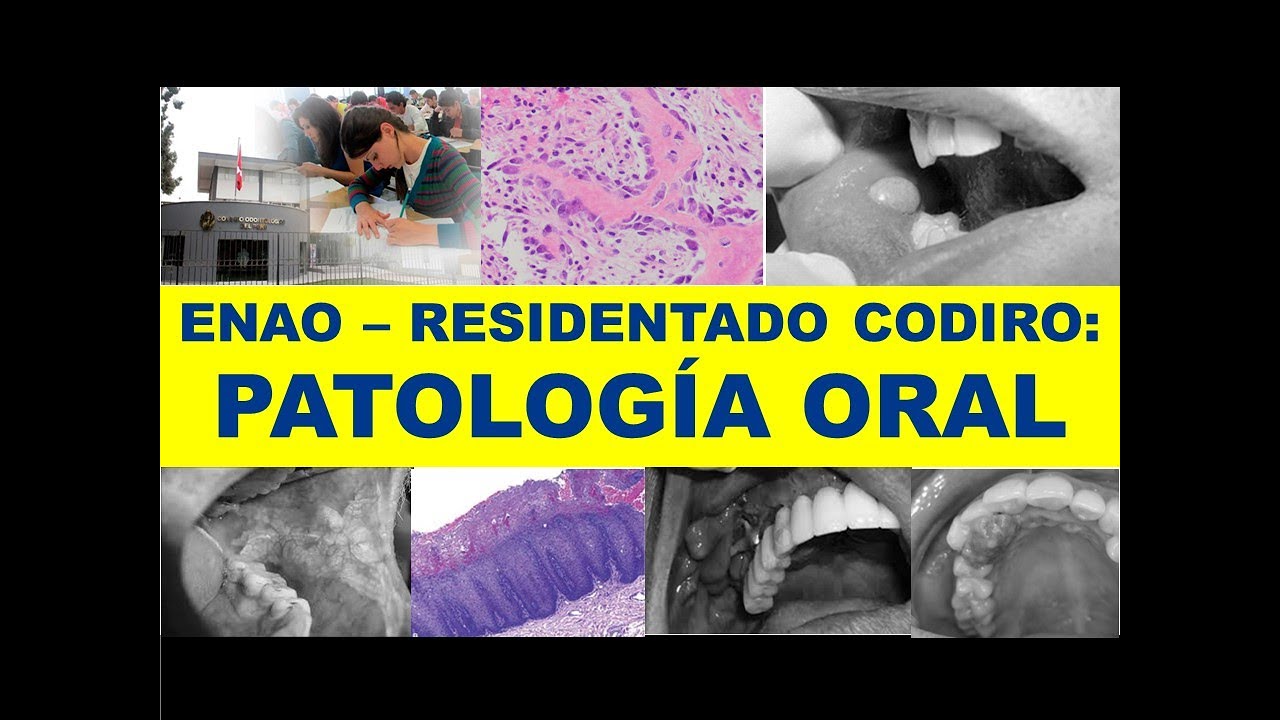 ENAO - RESIDENTADO ODONTOLÓGICO: PATOLOGÍA ORAL