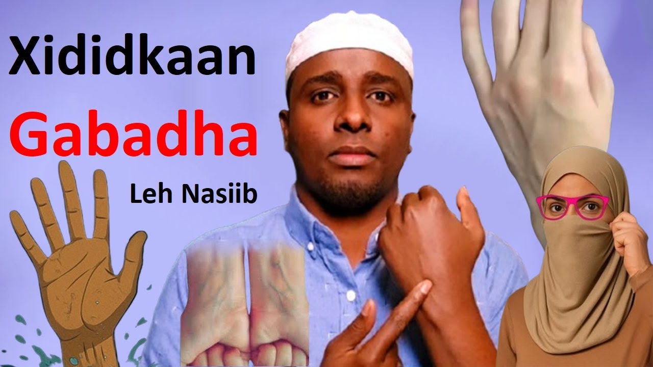 Qofka Xididkan jirkiisa ka muuqdo malaayiin Ruux ka nasiib Badanyahay xididada Gacanta Gabar & wiil