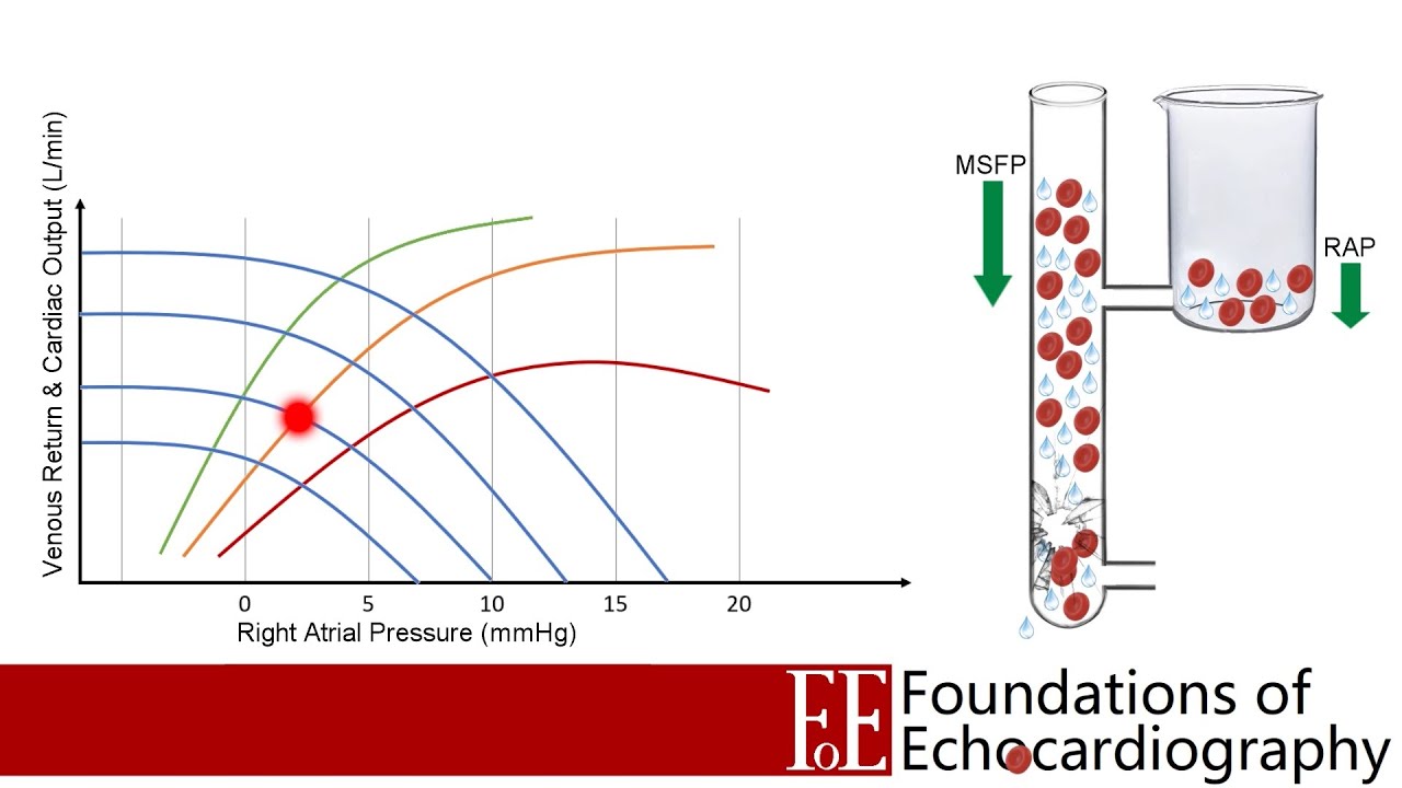 Level 1 Video Lecture: Volume Assessment (Part 1)