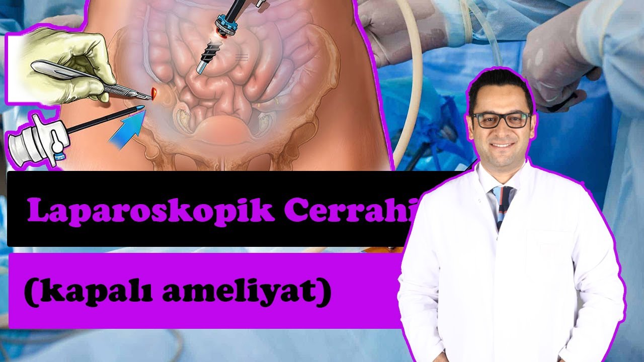 LAPAROSKOPİK (KAPALI) AMELİYAT OLACAKLAR ('Açık ameliyatlar' tarihe mi karışıyor? )