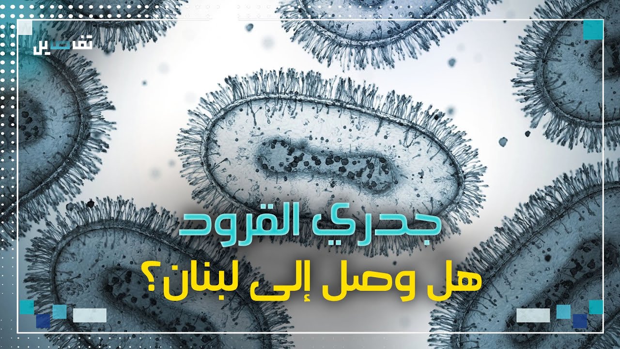 جدري القرود: هل وصل إلى لبنان؟