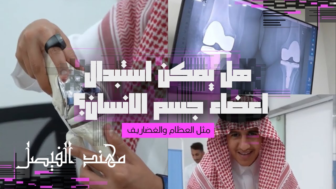 هل يمكن ان تستبدل اعضاء الانسان ؟؟؟ - مهند الفيصل