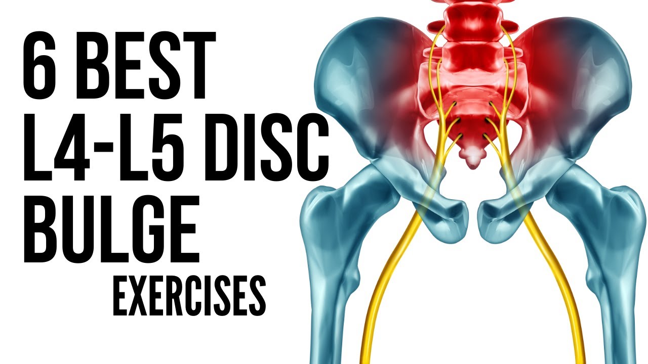 6 Best L4 L5 Disc Bulge Exercises in Hindi to avoid surgery