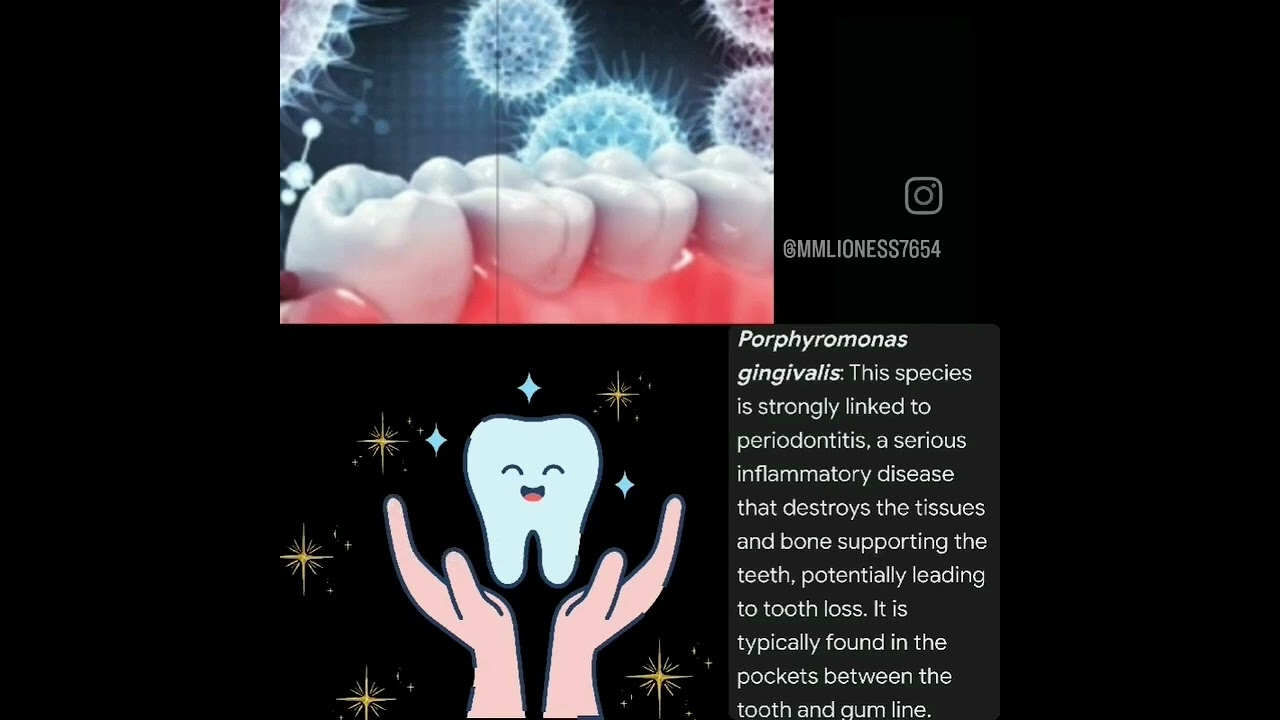 let's play hide&seek 🎮 with bacteria,protect ur teeth with cleaning from spy bacteria.!