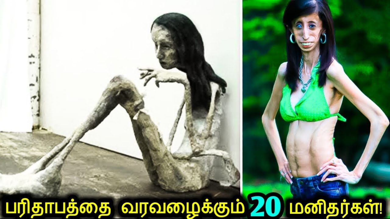 கண்ணீர் வரவைக்கும் பரிதாபத்துடன் உலகில் வாழும் 20 பாவப்பட்ட மனிதர்கள்! | Unbelievable Peoples