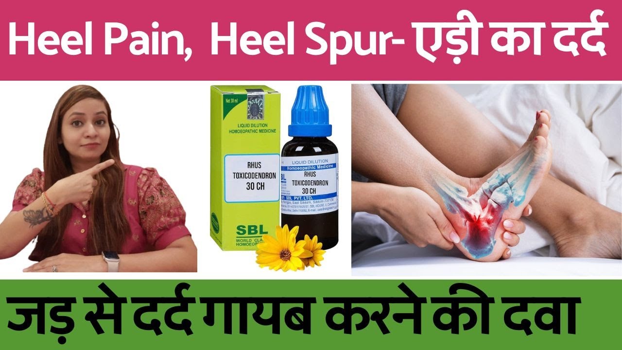 adi ke dard ka ilaj, karan, upay, kyun hota hai | heel spur homeopathic treatment in hindi