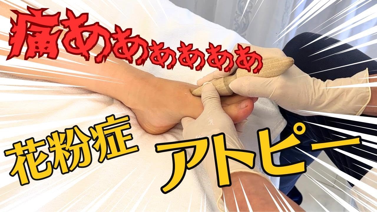 激痛を乗り越え《花粉症・アトピー》を足つぼで攻略したい！