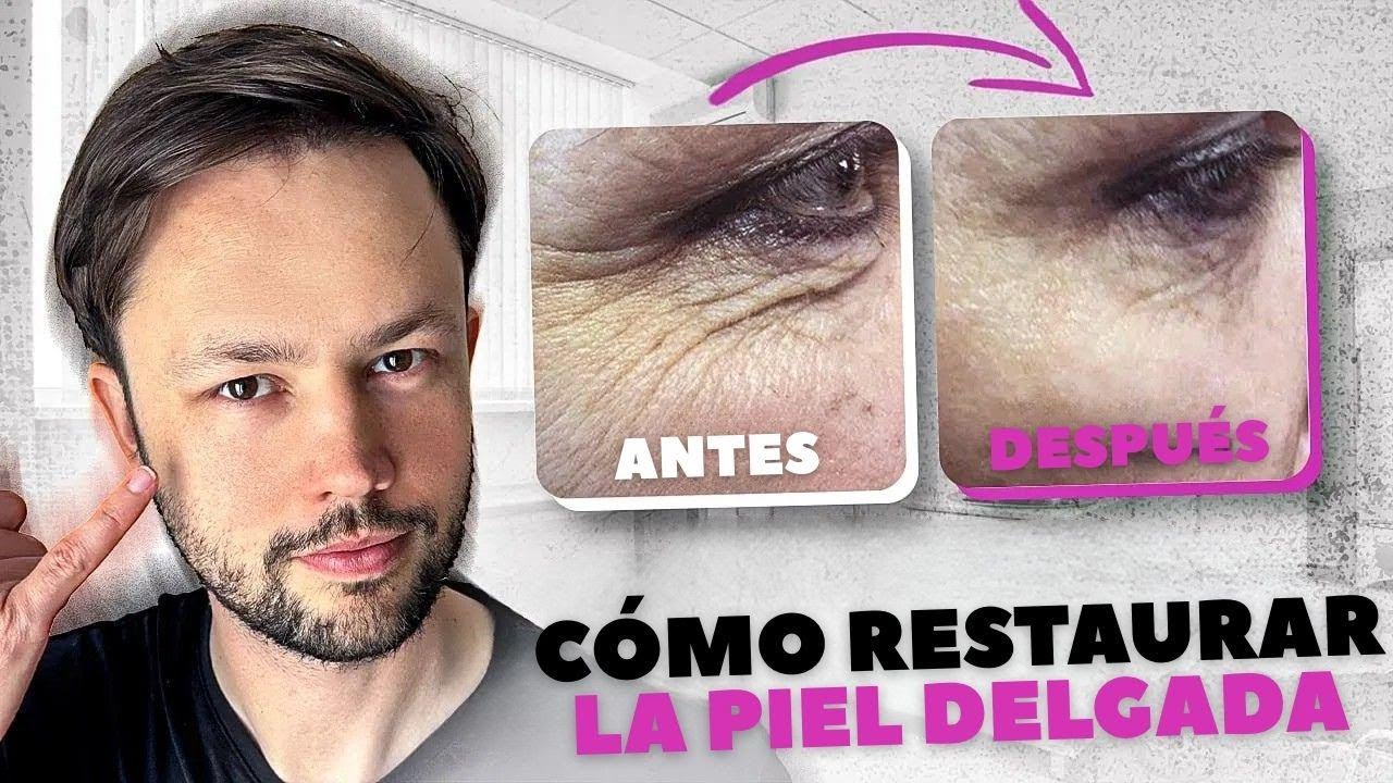 ¿Tu piel está más delgada? Descubre cómo recuperarla rápidamente