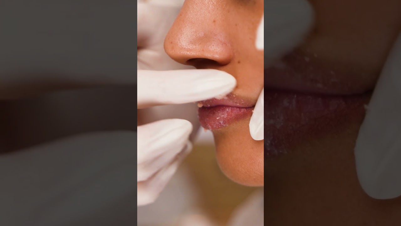 Protocolo: Bio.Filler Lip Booster Hidra Plus | Bioage Profissional!