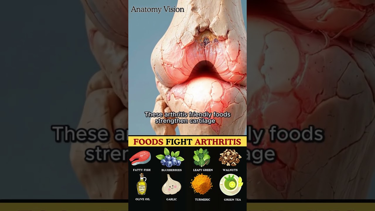 8 Must-Eat Foods for Arthritis Relief and Better Joint Mobility