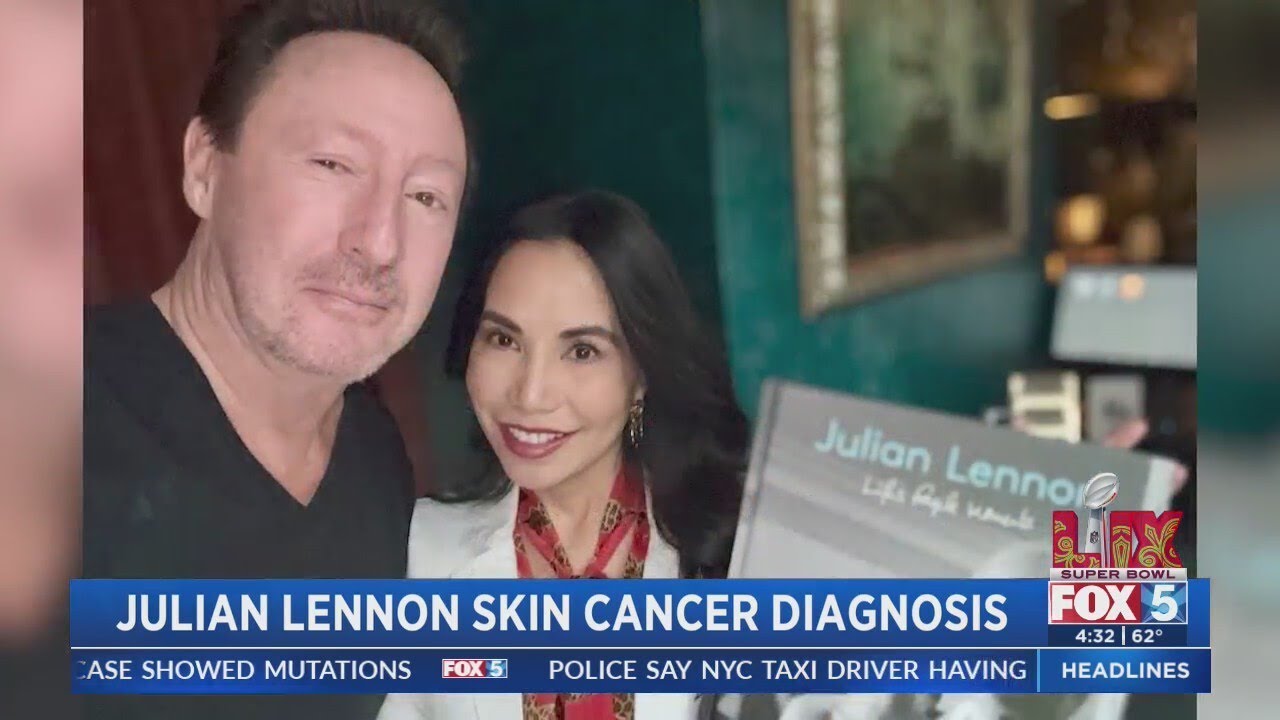 John Lennon's son Julian learns skin cancer diagnosis