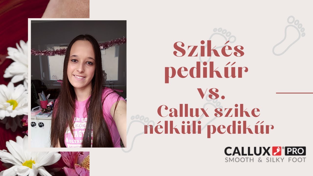 Szik&eacute;s pedikűr vs. Callux szike n&eacute;lk&uuml;li pedikűr